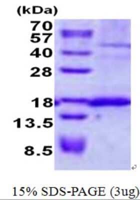 SDS-PAGE: Recombinant Human Signal sequence receptor delta His Protein [NBP2-22803]