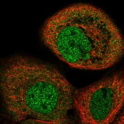 Immunocytochemistry/ Immunofluorescence: Sin1/MAPKAP1 Antibody [NBP1-89568]