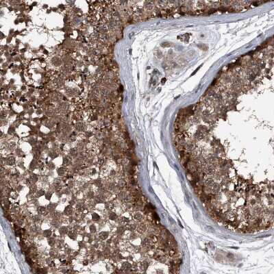 Immunohistochemistry-Paraffin: Sin1/MAPKAP1 Antibody [NBP1-89569]