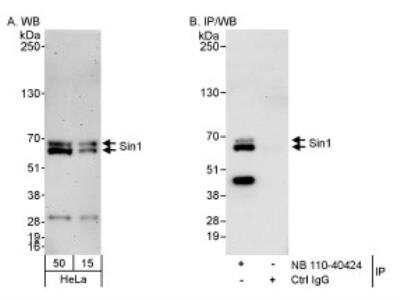 Western Blot: Sin1/MAPKAP1 Antibody [NB110-40424]