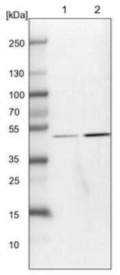 Western Blot: Sin1/MAPKAP1 Antibody [NBP1-89569]