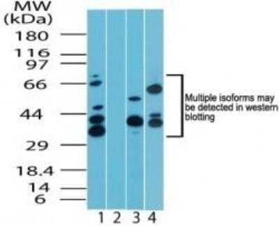 Western Blot: Sin1/MAPKAP1 Antibody [NBP2-24523]