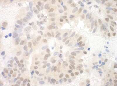 Immunohistochemistry: Sin3A-associated protein Antibody [NBP1-97744]