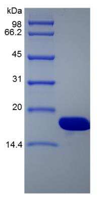 SDS-PAGE: Recombinant Single-stranded DNA Binding Protein [NBP2-35314]
