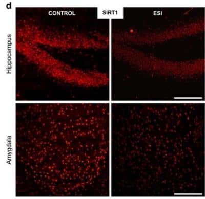 Immunohistochemistry: Sirtuin 1/SIRT1 Antibody (1F3) - BSA Free [NBP1-51641]