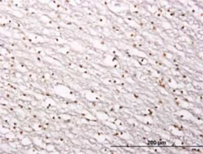 Immunohistochemistry-Paraffin: Sirtuin 1/SIRT1 Antibody (7B7) [H00023411-M01]