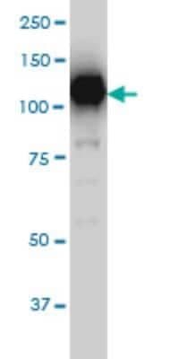 Western Blot: Sirtuin 1/SIRT1 Antibody (7B7) [H00023411-M01]