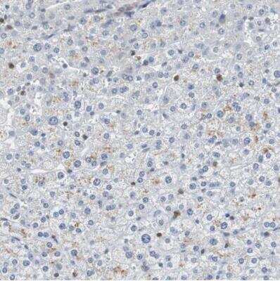 Immunohistochemistry-Paraffin: Sirtuin 1/SIRT1 Antibody [NBP1-87038]