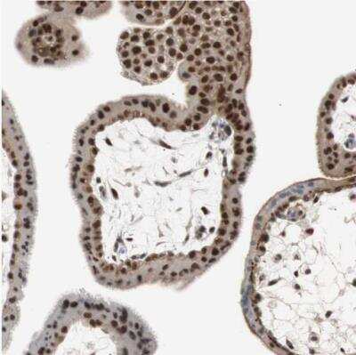 Immunohistochemistry-Paraffin: Sirtuin 1/SIRT1 Antibody [NBP1-87038]