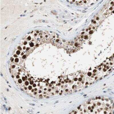 Immunohistochemistry-Paraffin: Sirtuin 1/SIRT1 Antibody [NBP1-87038]