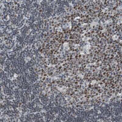 Immunohistochemistry-Paraffin: Sirtuin 1/SIRT1 Antibody [NBP1-87038]