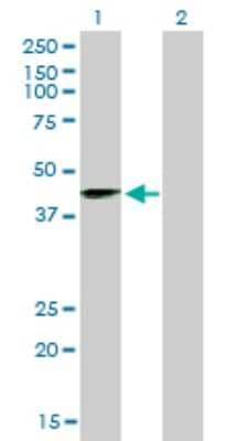 Western Blot: Sirtuin 2/SIRT2 Antibody (4B11) [H00022933-M01]