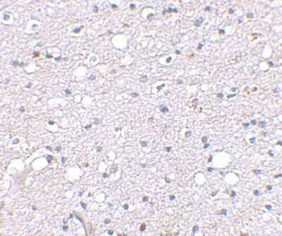 Immunohistochemistry-Paraffin: Sirtuin 2/SIRT2 Antibody - BSA Free [NBP1-76880]