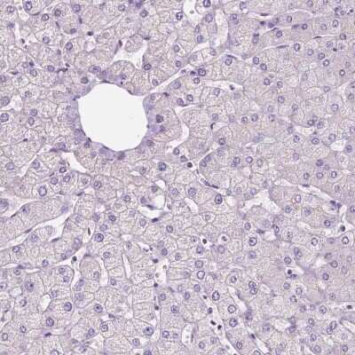 Immunohistochemistry-Paraffin: Sirtuin 2/SIRT2 Antibody [NBP1-87039]