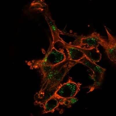 Immunocytochemistry/ Immunofluorescence: Sirtuin 2/SIRT2 Antibody (PCRP-SIRT2-1A8) - Azide and BSA Free [NBP3-08293]