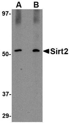 Western Blot: Sirtuin 2/SIRT2 AntibodyBSA Free [NBP1-76879]