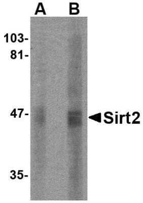 Western Blot: Sirtuin 2/SIRT2 AntibodyBSA Free [NBP1-76880]