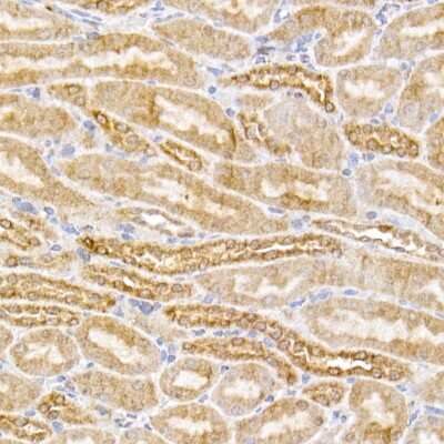 Immunohistochemistry-Paraffin: Sirtuin 3/SIRT3 Antibody (7O4G7) [NBP3-16083]