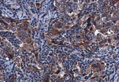 Immunohistochemistry-Paraffin: Sirtuin 3/SIRT3 Antibody [NBP1-31029]