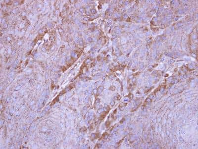Immunohistochemistry-Paraffin: Sirtuin 3/SIRT3 Antibody [NBP1-31029]