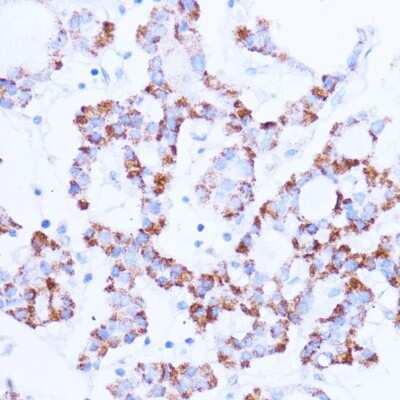 Immunohistochemistry-Paraffin: Sirtuin 3/SIRT3 Antibody - Azide and BSA Free [NBP3-02984]