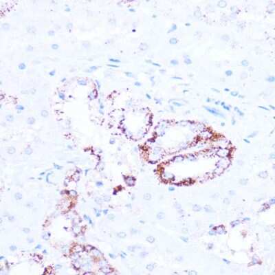 Immunohistochemistry-Paraffin: Sirtuin 3/SIRT3 Antibody - Azide and BSA Free [NBP3-02984]