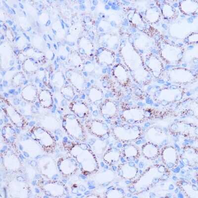 Immunohistochemistry-Paraffin: Sirtuin 3/SIRT3 Antibody - Azide and BSA Free [NBP3-02984]