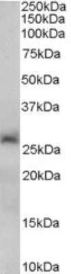 Western Blot: Sirtuin 3/SIRT3 Antibody [NB600-808]