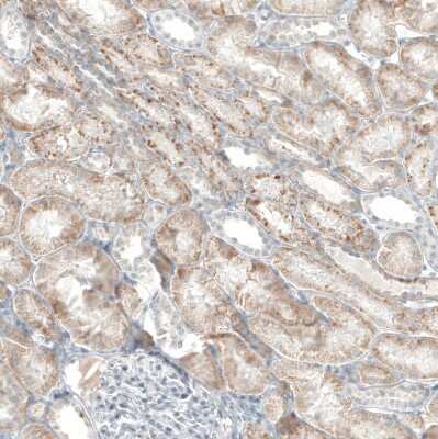 Immunohistochemistry-Paraffin: Sirtuin 5/SIRT5 Antibody [NBP1-86013]