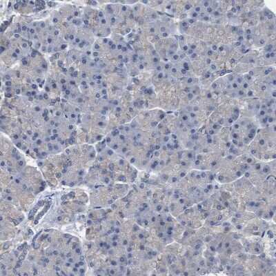 Immunohistochemistry-Paraffin: Sirtuin 5/SIRT5 Antibody [NBP1-86013]