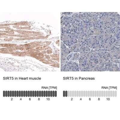 Immunohistochemistry-Paraffin: Sirtuin 5/SIRT5 Antibody [NBP1-86013]