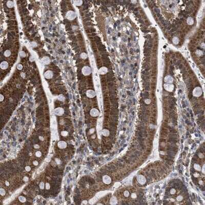 Immunohistochemistry-Paraffin: Sirtuin 5/SIRT5 Antibody [NBP1-89535]