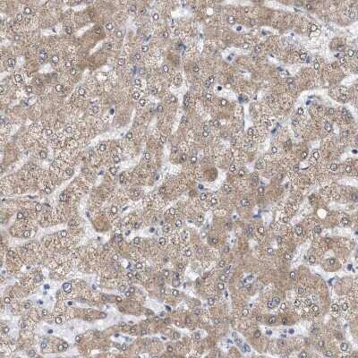 Immunohistochemistry-Paraffin: Sirtuin 5/SIRT5 Antibody [NBP1-89535]