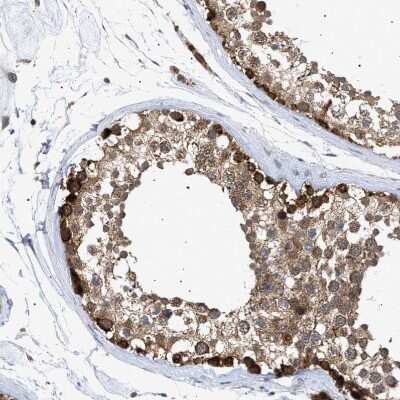 Immunohistochemistry-Paraffin: Sirtuin 5/SIRT5 Antibody [NBP1-89535]