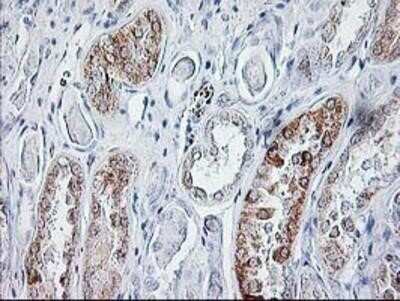 Immunohistochemistry: Sirtuin 5/SIRT5 Antibody (OTI2F1) - Azide and BSA Free [NBP2-74199]