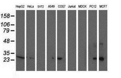 Western Blot: Sirtuin 5/SIRT5 Antibody (OTI2F1)Azide and BSA Free [NBP2-74199]