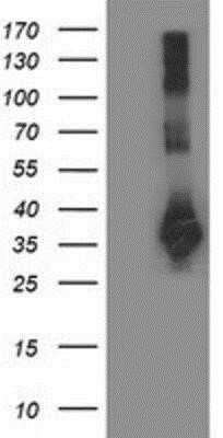 Western Blot: Sirtuin 5/SIRT5 Antibody (OTI2F1)Azide and BSA Free [NBP2-74199]