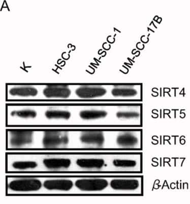 Western Blot: Sirtuin 5/SIRT5 Antibody [NB100-56372]