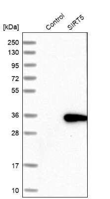 Western Blot: Sirtuin 5/SIRT5 Antibody [NBP1-86004]