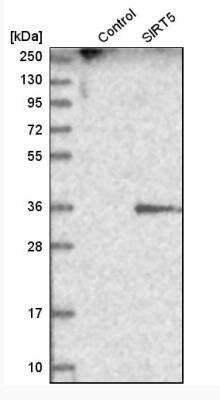 Western Blot: Sirtuin 5/SIRT5 Antibody [NBP1-86013]