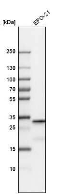 Western Blot: Sirtuin 5/SIRT5 Antibody [NBP1-89535]