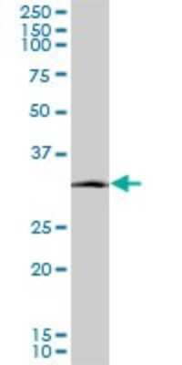 Western Blot: SIX3 Antibody (2B9) [H00006496-M08]