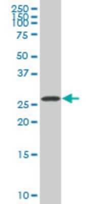 Western Blot: SIX3 Antibody (2B9) [H00006496-M08]