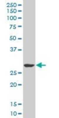 Western Blot: SIX3 Antibody (3D12) [H00006496-M01]