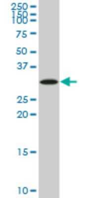 Western Blot: SIX3 Antibody (3D12) [H00006496-M01]