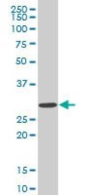Western Blot: SIX3 Antibody (3F1) [H00006496-M02]