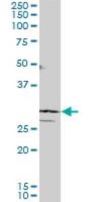 Western Blot: SIX3 Antibody (4H6) [H00006496-M10]