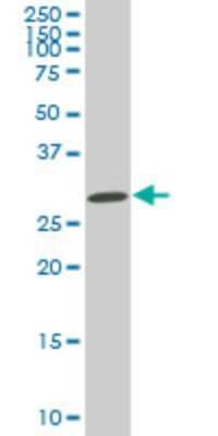 Western Blot: SIX3 Antibody (4H6) [H00006496-M10]