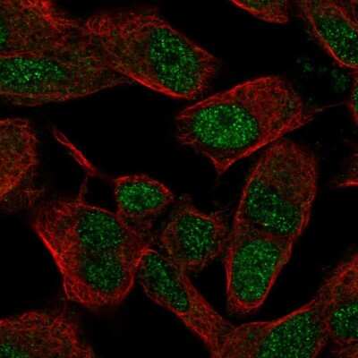 Immunocytochemistry/ Immunofluorescence: SIX3 Antibody [NBP2-57249]