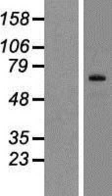 Western Blot: SIX5 Overexpression Lysate [NBP2-05043]